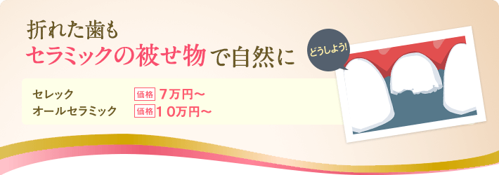 折れた歯もセラミックの被せ物で自然に