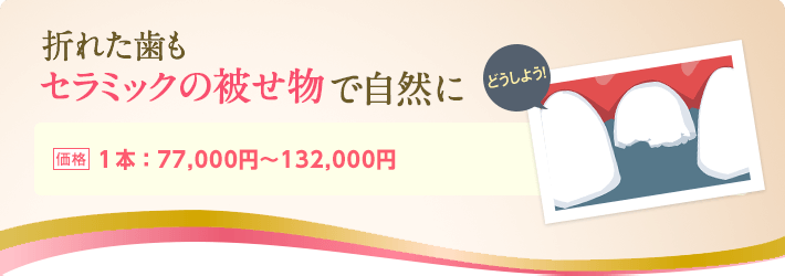 折れた歯もセラミックの被せ物で自然に