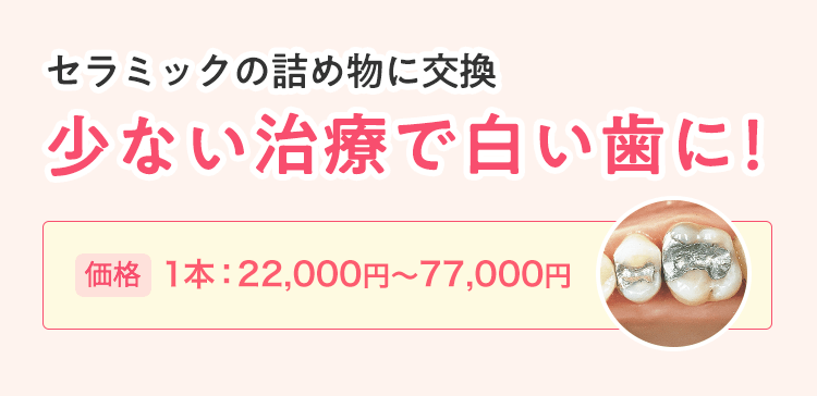 少ない治療で白い歯に