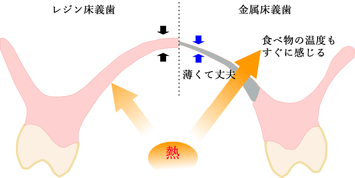 金属床