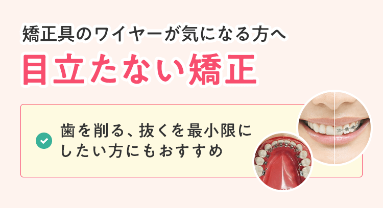 矯正具のワイヤーが気になる方へ目立たない矯正